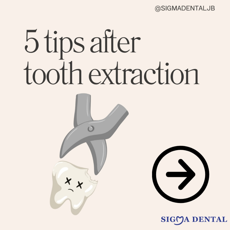 5 Tips after Tooth Extraction